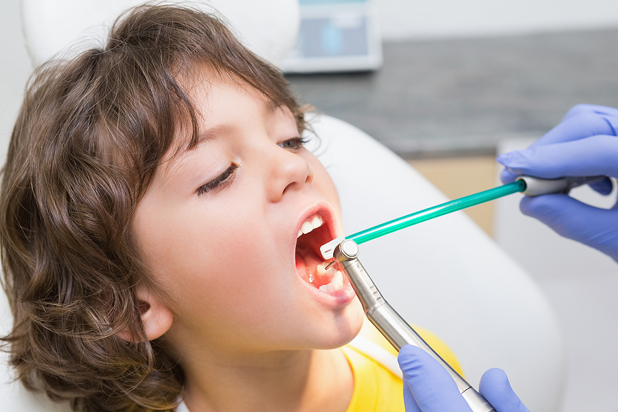 Gentle Care for Little Smiles: Dental Fillings Explained