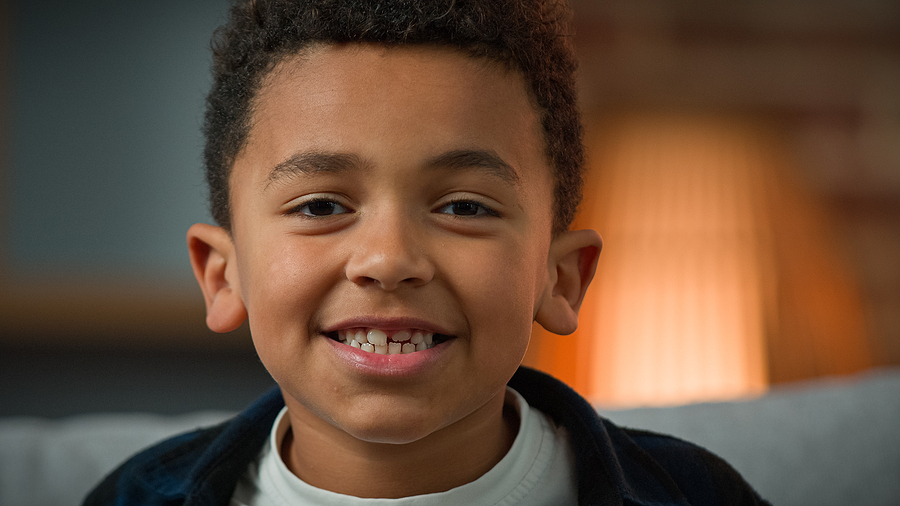Dental Sealants: Protecting Your Children’s Teeth